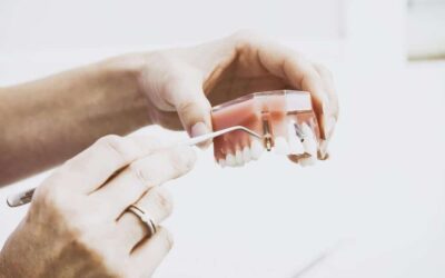 4 Tips for Reversing Gum Disease