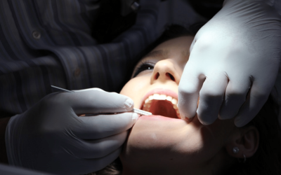 What Happens During Sedation Dentistry