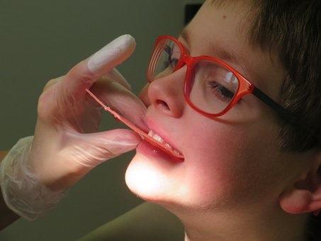 Child patient treated by NW Calgary Dentist